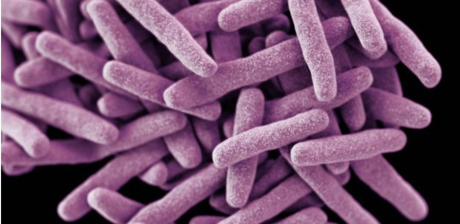 The Bacteria That Refuses to Die: Inside the Tuberculosis Crisis